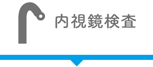 内視鏡検査